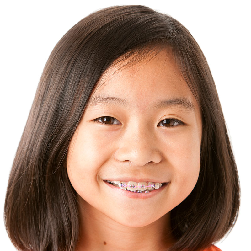 How do I know if my child or I need dental braces or orthodontic treatment?